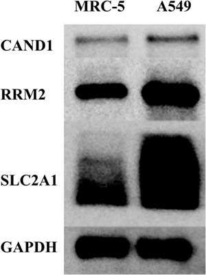 m7G-Associated subtypes, tumor microenvironment, and validation of prognostic signature in lung adenocarcinoma